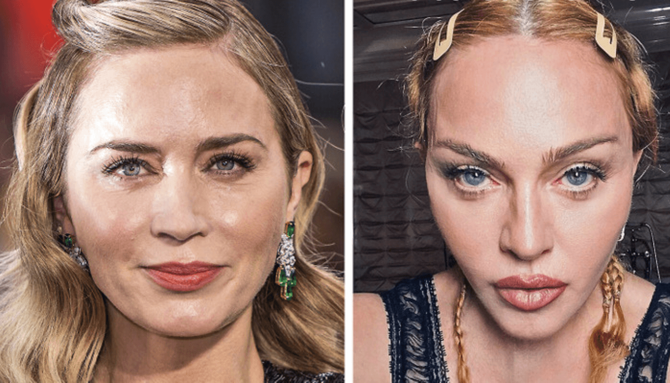 emily blunt plastic surgery